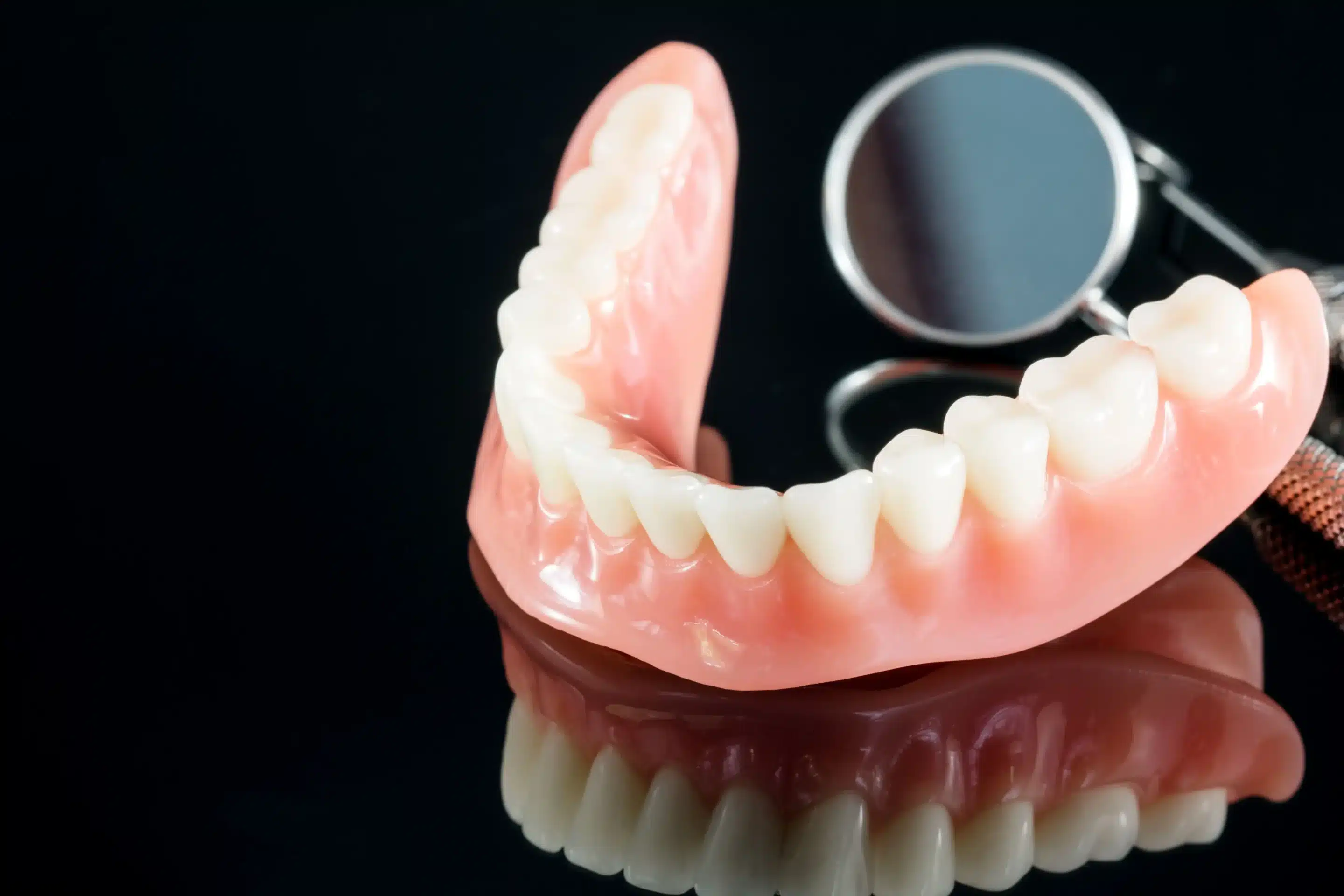 modelo-dientes-que-muestra-modelo-puente-corona-implante-protesis-dental-clinica dental sevilla koresdent