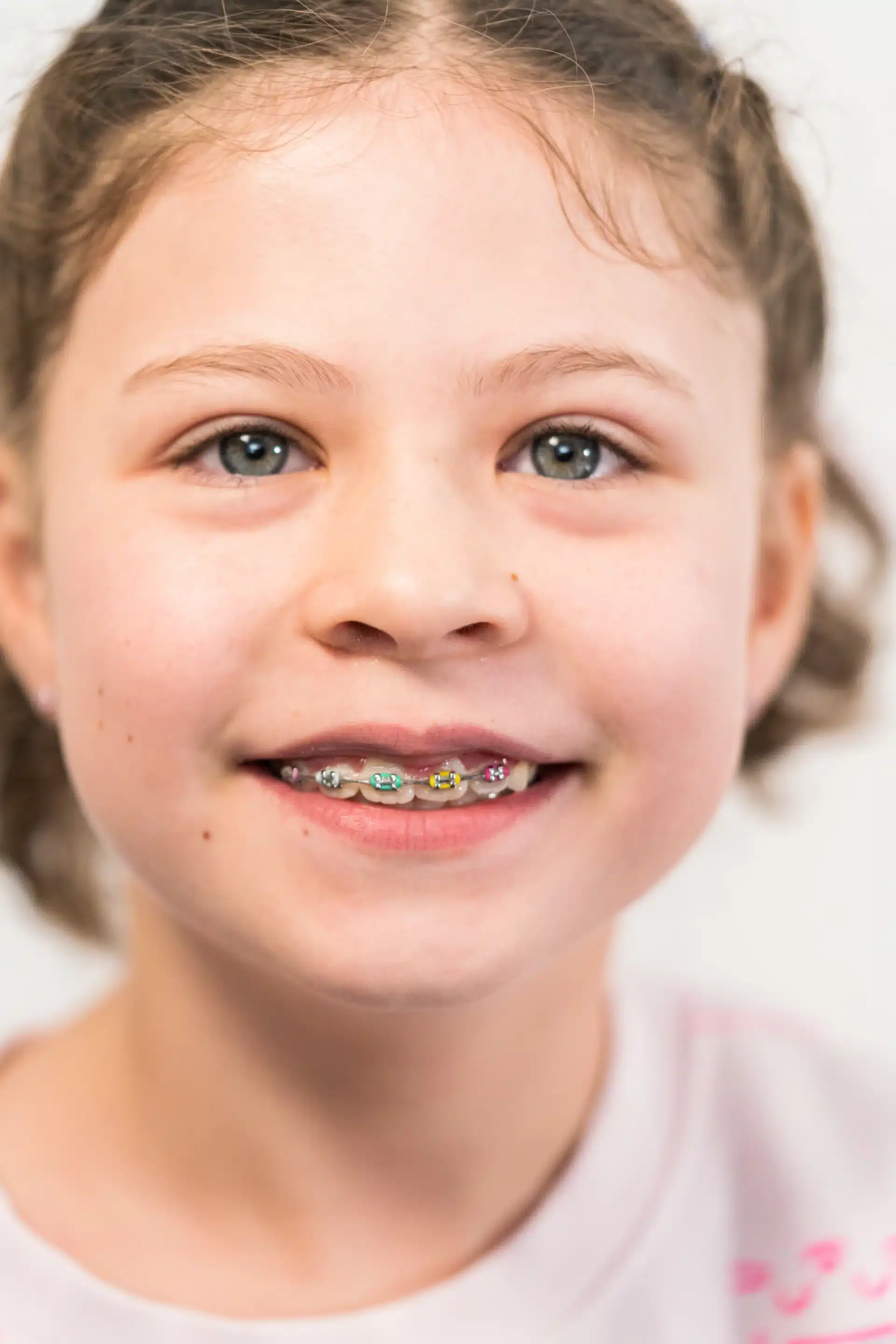 ortodoncia infantil en sevilla clinica dental koresdent